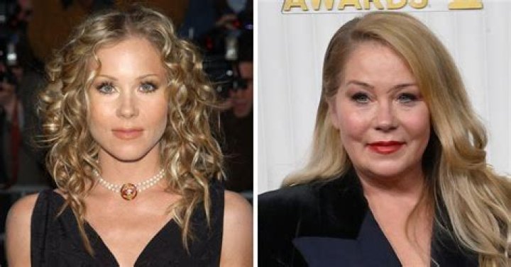 
Christina Applegate Claims Plastic Surgery Changed Her Look, Not MS 